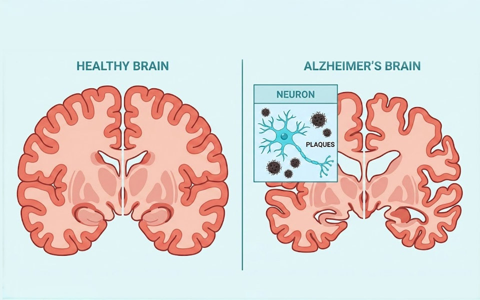 The Natural "Brain Battery" Booster Helping Seniors Stay Sharp